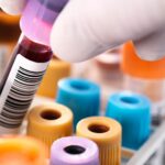 Yapay Zeka Öğrenimi ile Hematolojik Hastalıkların Teşhisi